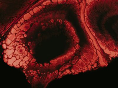 brown and black cracked skin