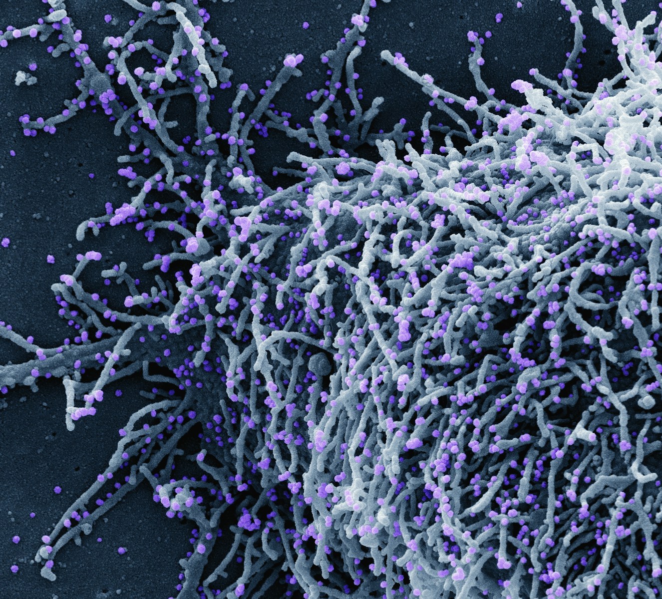a close up of a purple and white substance